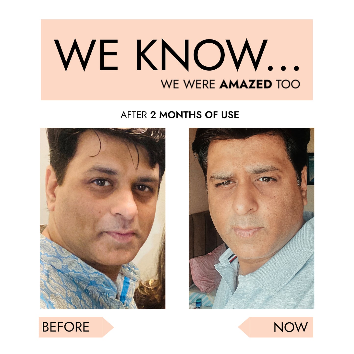 Shruum 360° Under Eye Cream